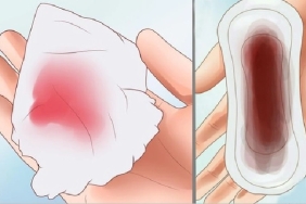 Adet kanınız parlak kırmızı veya siyah ise kesinlikle gözardı etmemelisiniz.