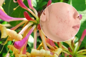 hanimeli-bitkisinin-cilde-faydalari-k