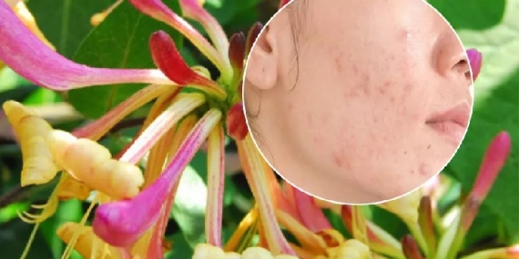 Hanımeli Bitkisinin Cilde Faydaları Neler?