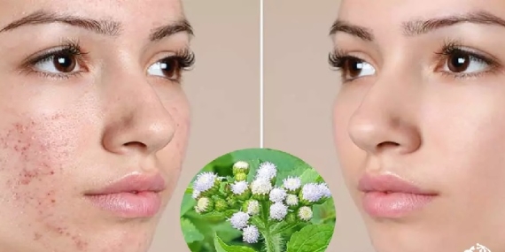 Lantana Çiçeğinin Cilde Faydaları